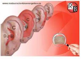 auriculopuntura