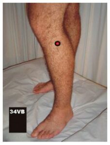 estancamientohumedad